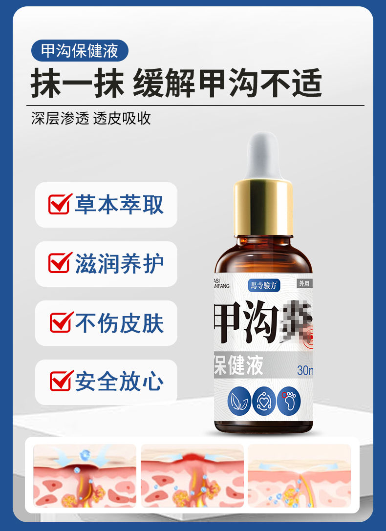 抹一抹，緩解甲溝不適